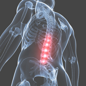 Osteopathic treatment for low back pain and sciatica